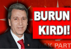 AKP'li Vekil burun kırdı!