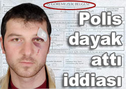 'Polis vatandaşa dayak attı' iddiası