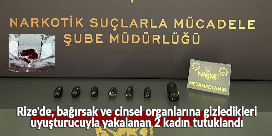 Bağırsak ve cinsel organlarında uyuşturucu sakladılar!