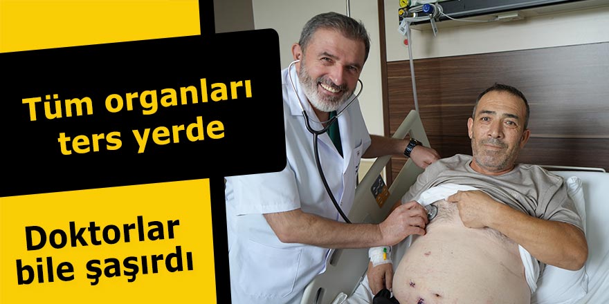 Tüm organları ters yerde: Doktorlar bile şaşırdı