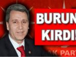 AKP'li Vekil burun kırdı!