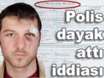 'Polis vatandaşa dayak attı' iddiası