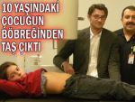 10 yaşındaki çocuğun böbreğinden taş çıktı