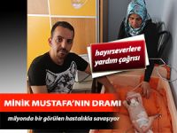 6 aylık Mustafa bebeğin yaşam mücadelesi