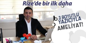 Rize'de 3 boyutlu yazıcıyla ameliyat!