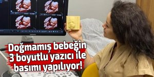 Doğmamış bebeğin 3 boyutlu yazıcı ile basımı yapılıyor!