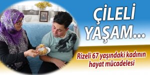 Rizeli 67 yaşındaki kadının hayat mücadelesi