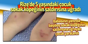 Rize’de 5 yaşındaki çocuk, sokak köpeğinin saldırısına uğradı