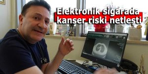 Elektronik sigarada, kanser riski netleşti
